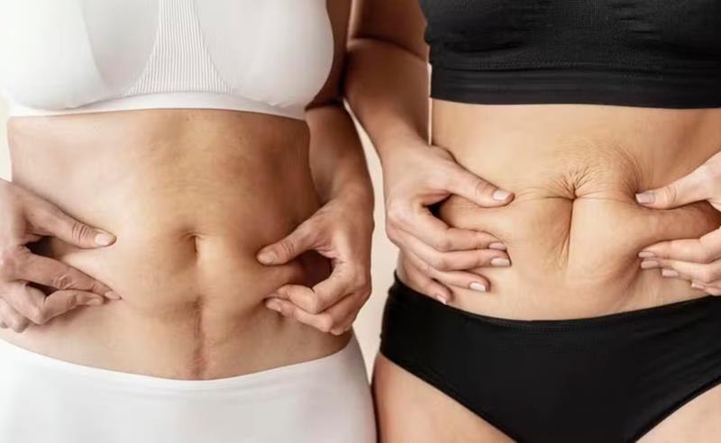 Dr. Octávio Curi Frascareli: Cirurgia da Mulher Moderna Pós-Gestação em Maringá: autoestima, firmeza e proporção