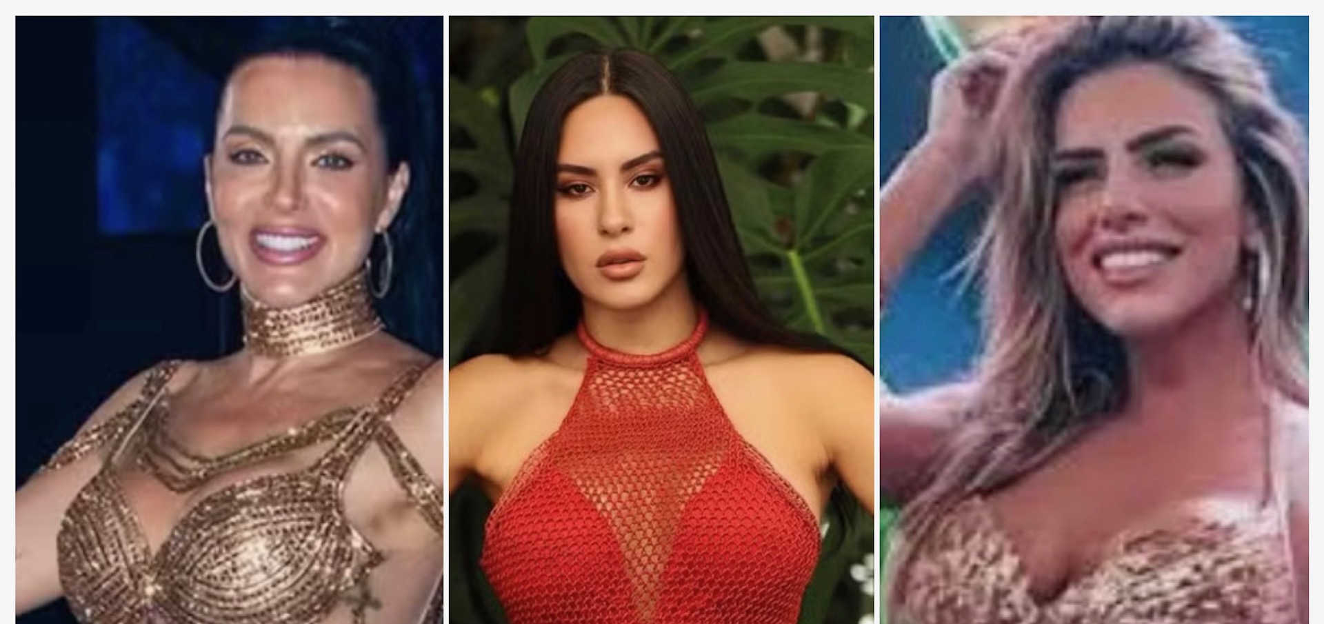Rainhas de bateria e musas do carnaval apostam em bioestimuladores de colágeno: entenda o procedimento