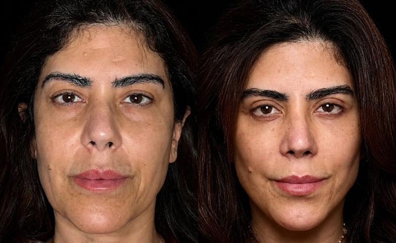 Dr. Thallys Santana e Elaine Cristina unem autoestima, imagem e reconstrução pessoal em transformação estética marcada por naturalidade
