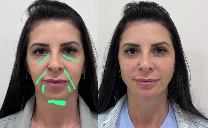 As sombras do rosto denunciam a idade